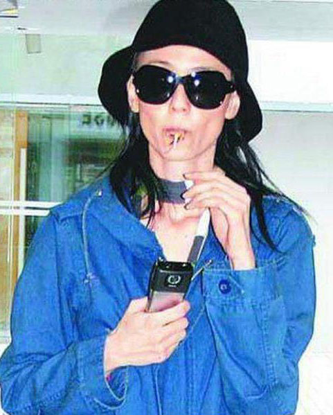 残不忍睹！曝前亚姐冠军韩君婷疑整容失败下巴变歪鼻子凹陷(6)