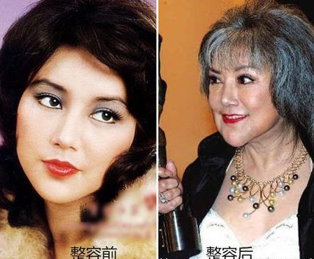 残不忍睹！曝前亚姐冠军韩君婷疑整容失败下巴变歪鼻子凹陷