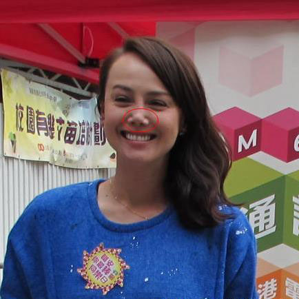 残不忍睹！曝前亚姐冠军韩君婷疑整容失败下巴变歪鼻子凹陷(2)