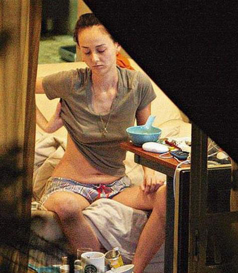 残不忍睹！曝前亚姐冠军韩君婷疑整容失败下巴变歪鼻子凹陷(7)