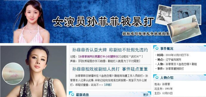 孙菲菲近照笑容僵硬不忍直视，扒扒她如何从第一古典美女作成了整容狂(10)