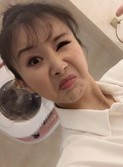 孙菲菲近照笑容僵硬不忍直视，扒扒她如何从第一古典美女作成了整容狂