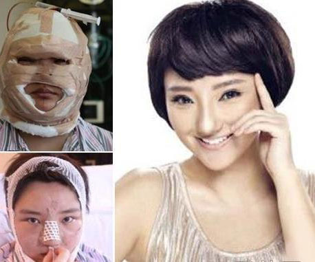 揭秘选秀钉子户：资质平平却不认命整容变毁容星途暗淡(7)