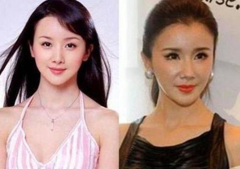 孙菲菲近照笑容僵硬不忍直视，扒扒她如何从第一古典美女作成了整容狂(3)