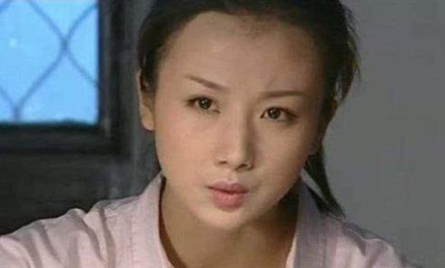 孙菲菲近照笑容僵硬不忍直视，扒扒她如何从第一古典美女作成了整容狂(5)