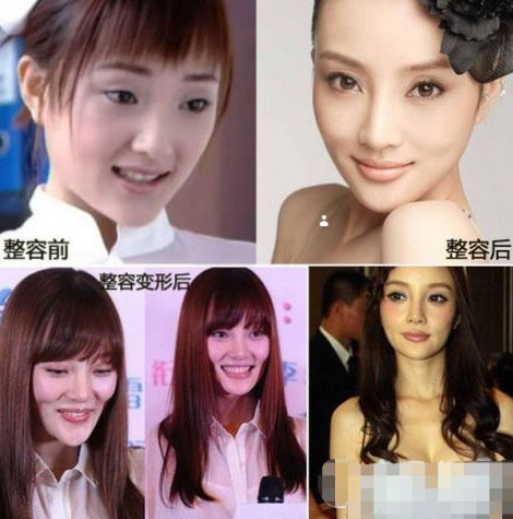 同一个医生？甘薇等假脸姐妹团合影看傻眼(5)