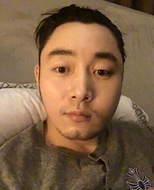 《甄嬛传》帅气多情果郡王李东学意外毁容(11)