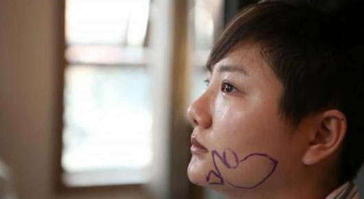 揭秘选秀钉子户：资质平平却不认命整容变毁容星途暗淡(6)