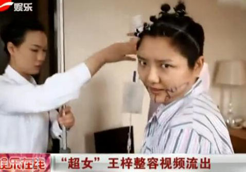 揭秘选秀钉子户:资质平平却不认命整容变毁容星途暗淡(5)