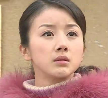 孙菲菲近照笑容僵硬不忍直视，扒扒她如何从第一古典美女作成了整容狂(7)