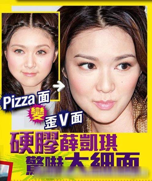 薛凯琪近照曝光被指圆脸变尖笑容僵硬(5)