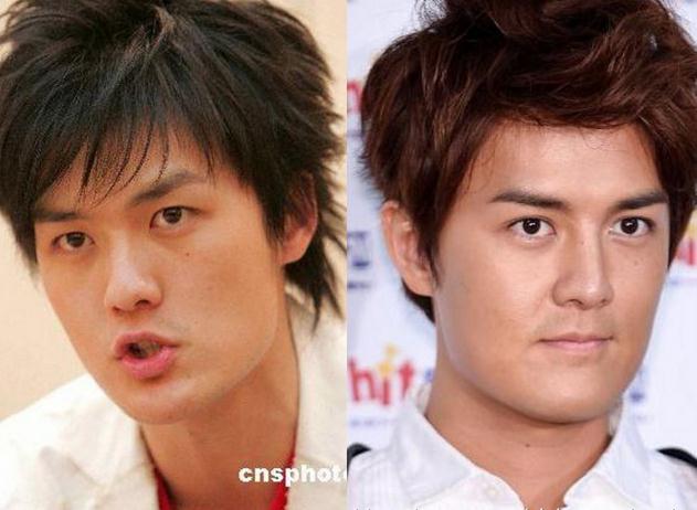 扒扒疑似整容过度连爹妈都认不出的10大男星(8)
