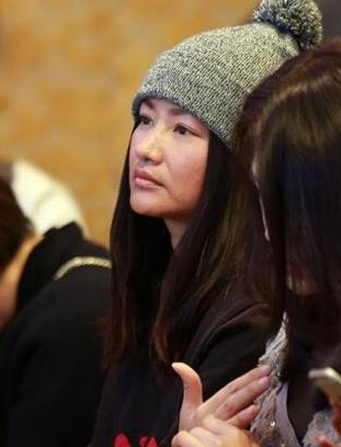 吓到我了！瞿颖近照曝光又黑又瘦整张脸惨不忍睹(7)