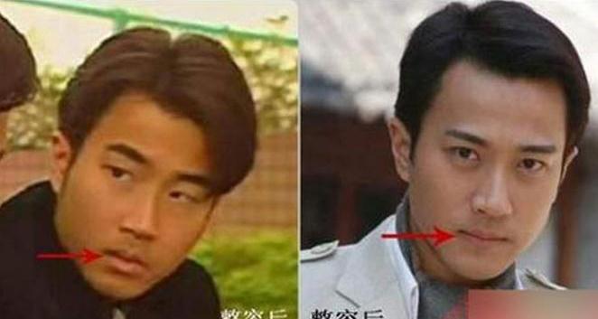 扒扒疑似整容过度连爹妈都认不出的10大男星(2)
