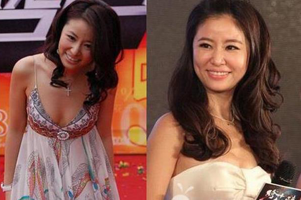 林心如昔日比基尼照曝光被指胸前无料(4)