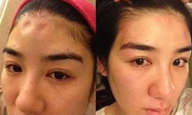 黄奕跨界投资美容行业当老板了，脸怎么却毁成这样？(8)