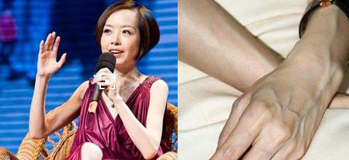 她从肥胖减肥瘦成骷髅，秒杀众女星等纸片人(3)