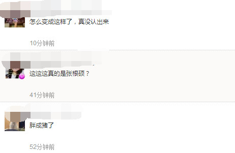 肿到飞起！张根硕近照脸部圆润双下巴明显惨不忍睹(2)
